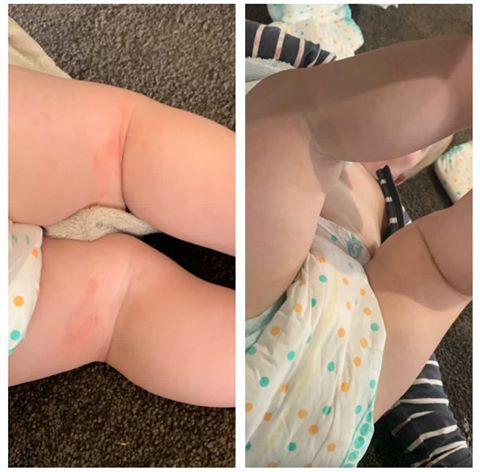 Wimmera Wellness Eczema Cream